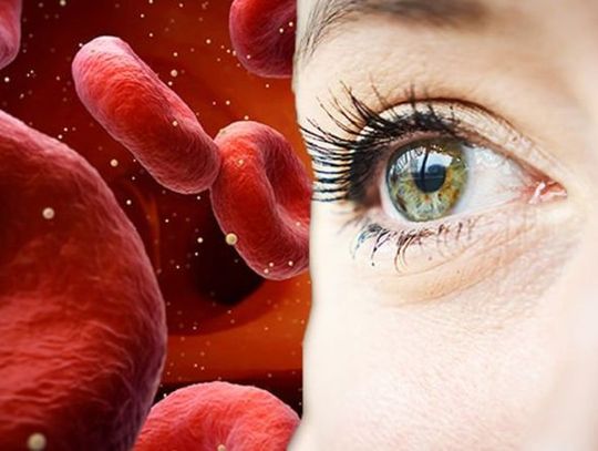 21 ważnych faktów na temat niedoboru witaminy B12