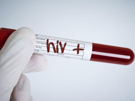 Coraz więcej przypadków HIV w Polsce. W większości nie wiadomo, jak doszło do zakażenia