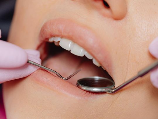 Licówki - co to takiego?