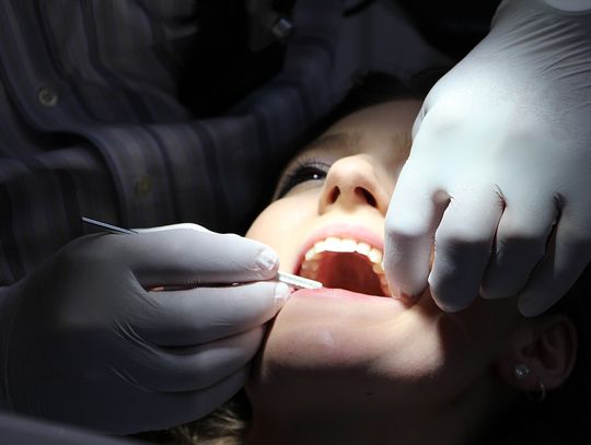 Obopólne korzyści w gabinecie stomatologicznym. Rękawice nitrylowe chronią zarówno lekarza, jak i pacjenta