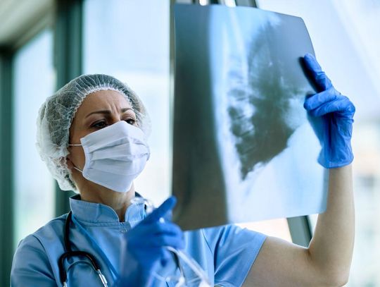 Zamojski Szpital Niepubliczny poszukuje pulmonologów, internistów i ordynatora oddziału chorób płuc Zamojski Szpital Niepubliczny poszukuje pulmonologów, internistów i ordynatora oddziału chorób płuc