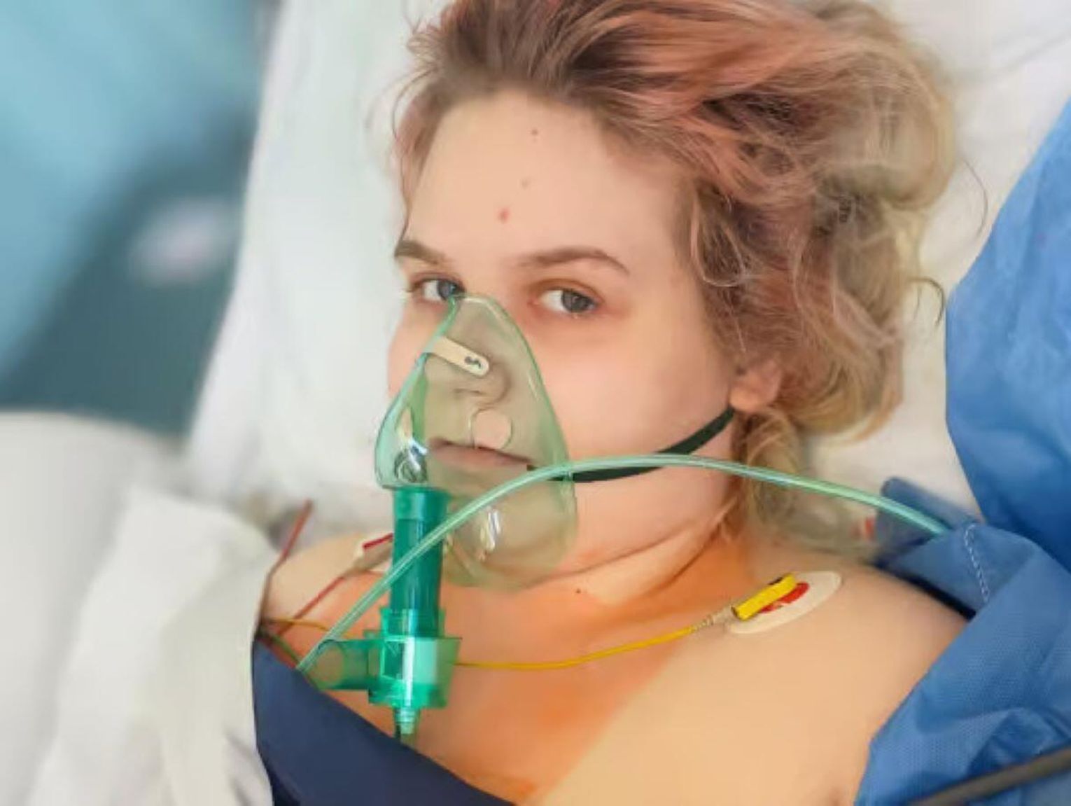 17-letnia Dominika z Zamościa walczy z ultrarzadkim nowotworem. Rodzina prosi o pomoc