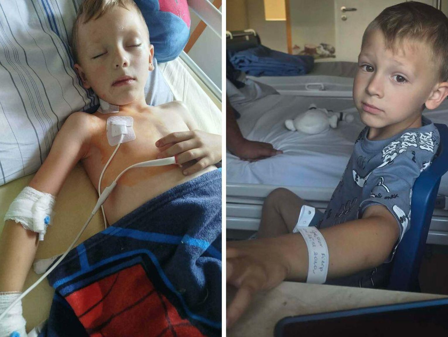5-letni Filipek z gminy Dołhobyczów walczy z ciężkim nowotworem. Jak można pomóc?